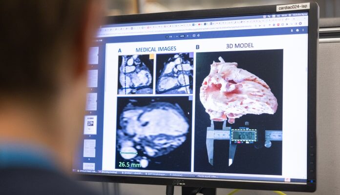 A man is looking at an image of a heart on a monitor.